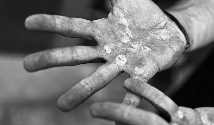 Save Your Skin (Literally): CrossFit Hand Care 101